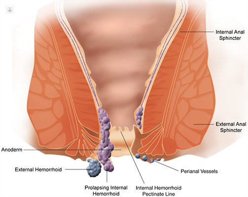 best piles surgeon in Kolkata.
