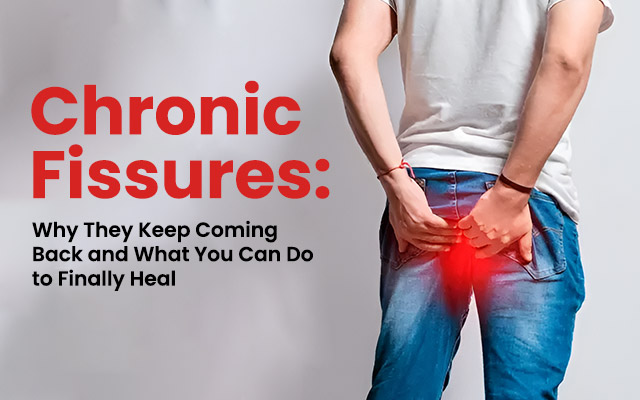 Chronic Fissures