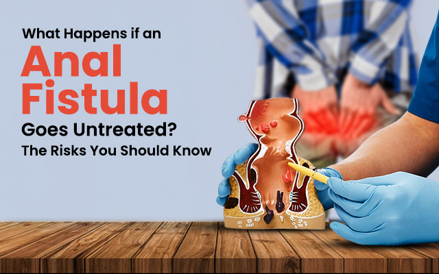 anal fistula