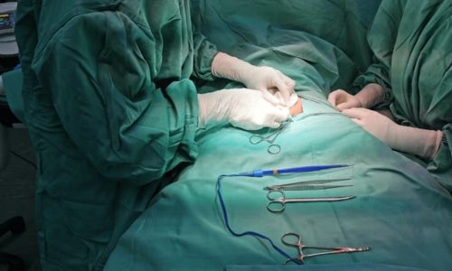 Cosmetic ZSR Circumcision