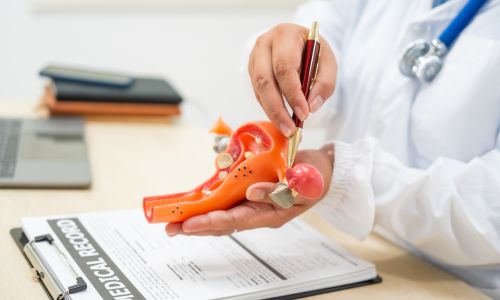 Suprasphincteric Fistula