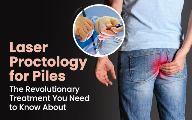 Laser Proctology for Piles: The Revolutionary Treatment You Need to Know About