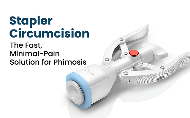 Stapler Circumcision: The Fast, Minimal-Pain Solution for Phimosis
