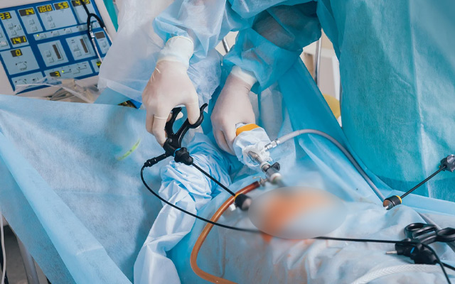 Surgeon performing laparoscopic gallbladder surgery using minimally invasive four-port technique with laparoscope and specialized instruments in a sterile operating theatre