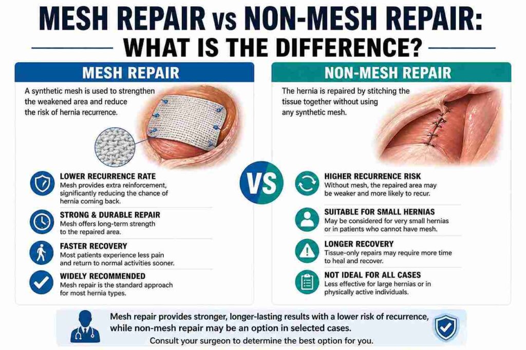 Infographic comparing mesh repair and non-mesh repair for hernias, highlighting differences in recurrence rates, repair strength, recovery times, and suitability for small hernias.