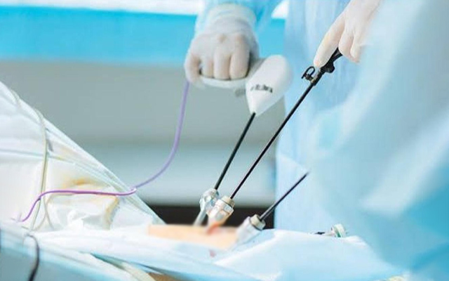 Surgeon performing minimally invasive laparoscopic gallbladder surgery for gallstone treatment and faster recovery.